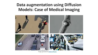 Data augmentation using Diffusion Models case of medical imaging
