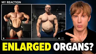 Dr Mike Israetel's Visceral Fat Scan Is Not Normal