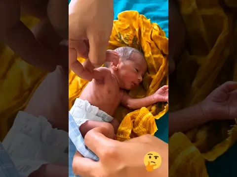 premature baby birth 😢😢 please pray for baby 🙏🙏 #premature #babybirth #adorable #shorts