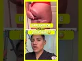 Download Lagu Implante de Glúteo ¡SALE MAL!