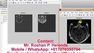 Image Fusion using Wavelet Transform Matlab Project Source Code