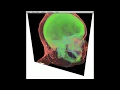 Demo - Direct Volume Rendering