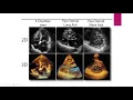 Echo for Medical Students