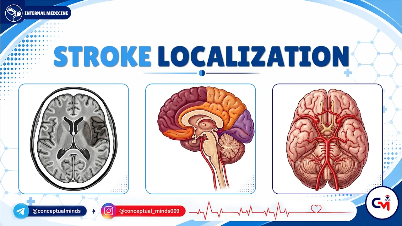 2. Stroke Localization | Neurology Internal Medicine | USMLE Step 2 CK Clinical Neuro Review