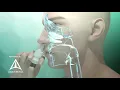 Fluticasone nasal spray Flonase - 3D medical animation