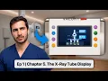 The X-Ray Tube Display The X-Ray Room Explained Ep 1 Ch 5
