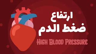 ارتفاع ضغط الدم                     دندنها