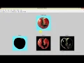 Fruit Disease Detection and Classification Using Image Processing Matlab Project Code