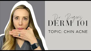 Chin Acne Causes Treatment and Prevention Tips Dermatologist s Guide