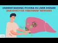 When Your Skin Crawls Decoding Itching Associated with Liver Disease