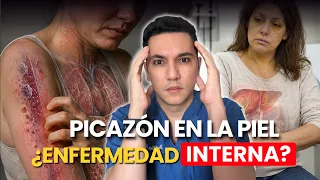 Estas enfermedades internas pueden causar picazón en la piel