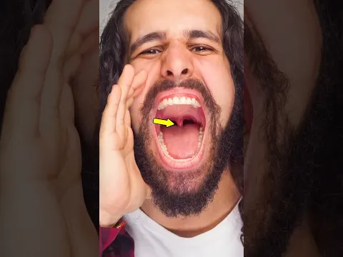 ايش بيصير اذا فقدت اللهاة بالصدفة 😎😎 #shortvideo