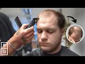 I Can Go Outside WITHOUT a Hat NOW Haircut after HIDING Thinning Hair Talking Hair Loss