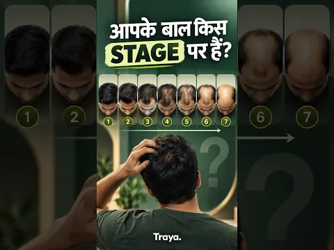 7 Stages of Hair Loss: Which Stage Are You In?