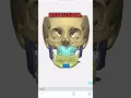 Download Lagu How to correct an asymmetric face through orthognathic surgery.