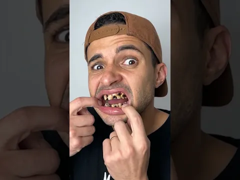 Não Fique Sem Escovar os Dentes