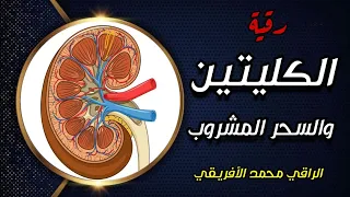 رقية الكليتين والسحر المشروب إستهداف الأسحار والمخططات ومسببات الأمراض العضوية بهن الشرح بالوصف 