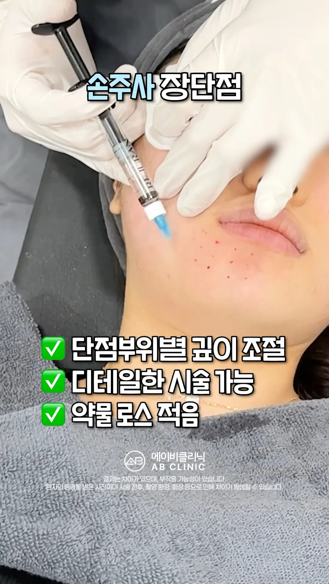 리쥬란 손주사 vs 인젝터 차이는?