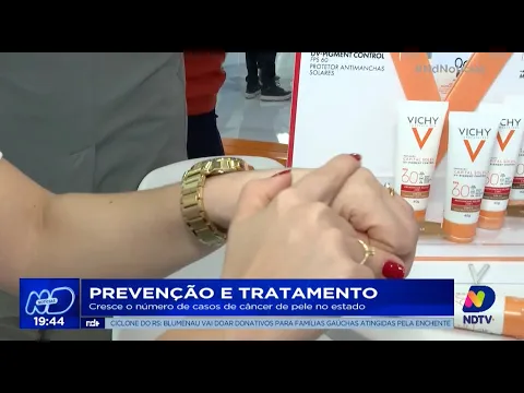 Prevenção e tratamento: cresce o número de casos de câncer de pele no Estado