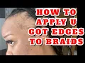 HOW TO COVER BALD SPOTS or NO EDGES U GOT EDGES x BRAIDS Severe Alopecia Instant Edges
