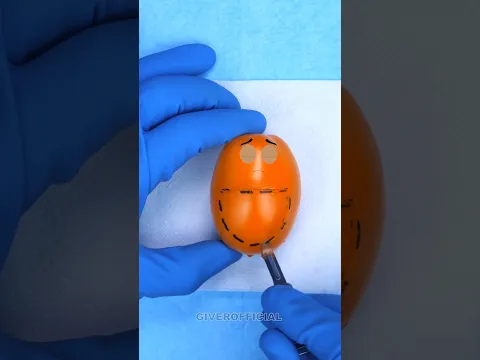 Tomato gives birth to a baby #fruitsurgery #shorts