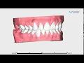 Download Lagu Bekijk wat AirSmile voor u kan betekenen