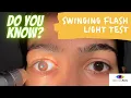 Swinging flash light test II How to examine RAPD II Assess relative afferent pupillary defect