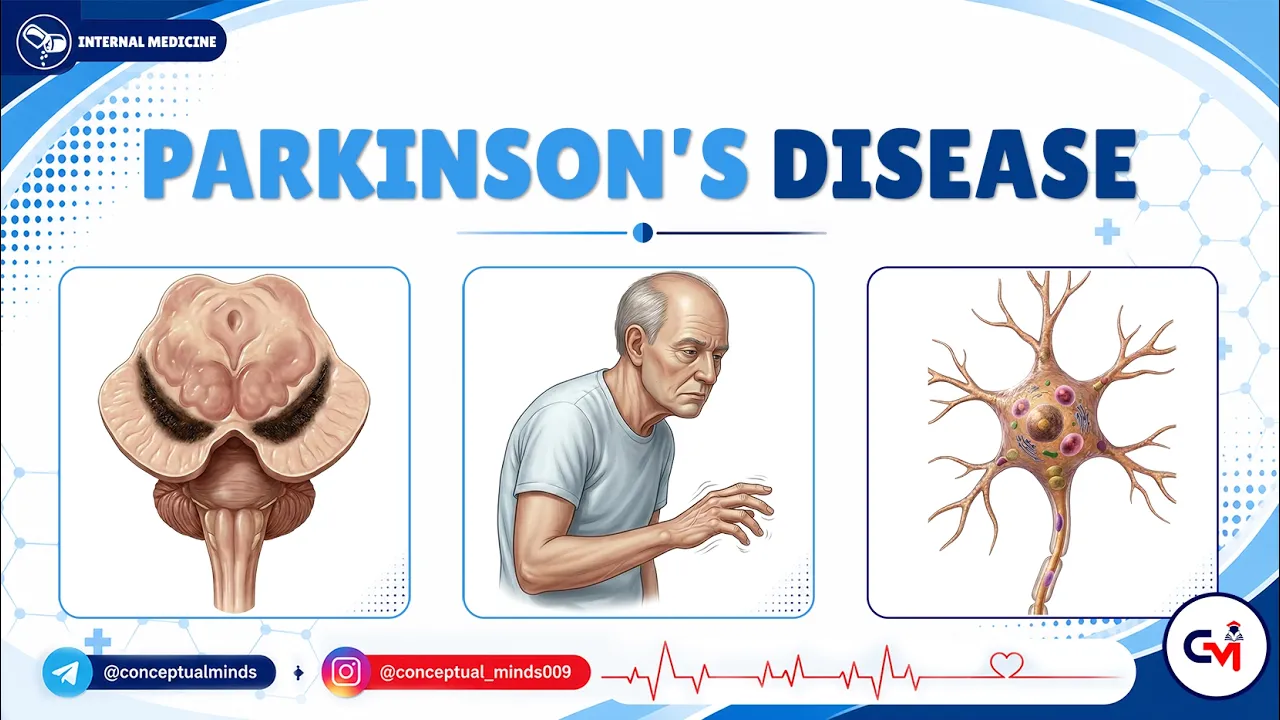 12. Parkinson’s Disease & Parkinson Plus Disorders | USMLE Step 2 CK | Neurology High-Yield