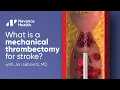 What is a Mechanical Thrombectomy for Stroke