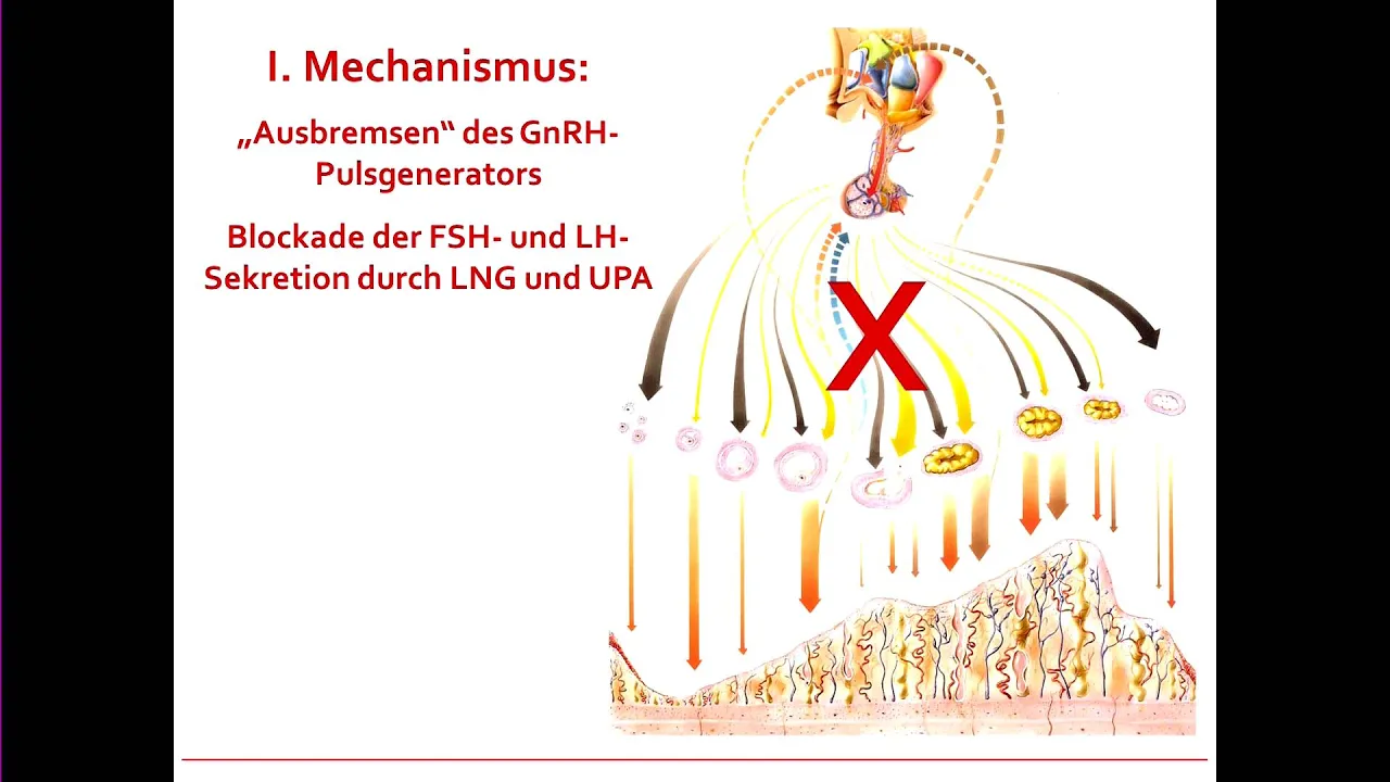 Sie gilt als eines der zuverlässigsten Verhütungsmittel überhaupt. Mehr als die Hälfte aller Frauen . 