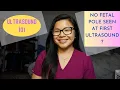 No Fetal Pole Seen At First Ultrasound What Could It Mean
