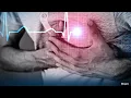 UW Health shares unique heart challenges men face
