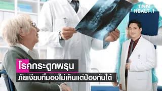 วิธีป้องกันและรักษาโรคกระดูกพรุนมีอะไรบ้าง