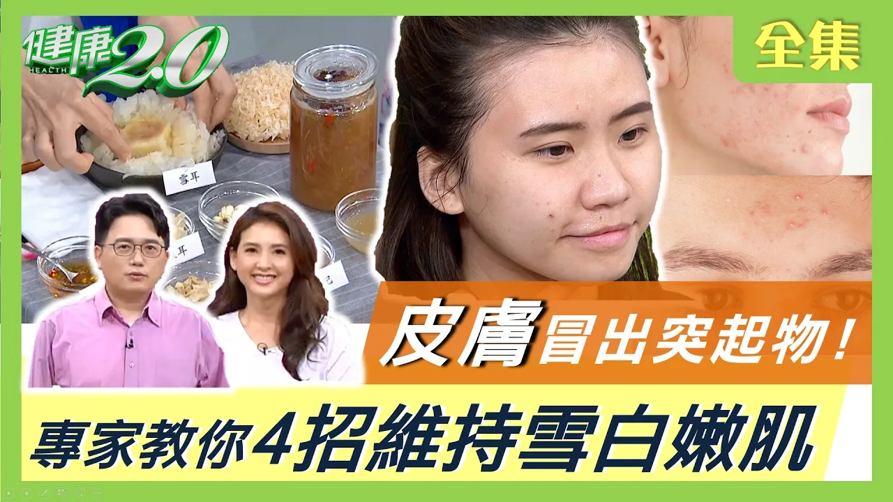 皮膚冒出突起物！是脂肪瘤、粉瘤、腫瘤還是青春痘？ 健康2.0 20210328 (完整版)