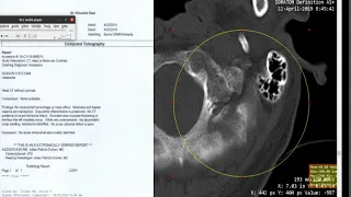 I Asked On reddit Is My Skull Broken