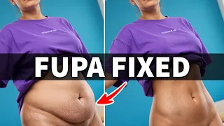 Day 1 of 6 | FIX FUPA for a Flat Stomach After 30