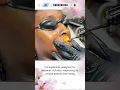 Download Lagu Lighter Lips for Every Shade – Especially Melanin-Rich Skin #picolaser #LaserForLips