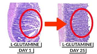 This Is THE BEST PROTOCOL To Fix Leaky Gut Naturally