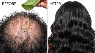How To Grow Long and Thicken Hair Faster With Aloevera Gel ! 7 Days Super Fast Hair Growth Challenge