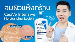 จบปัญหาผิวแห้งกร้าน ผิวลอกถึงขั้นสุด ด้วย CeraVe Intensive Moisturising Lotion