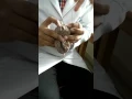 Rectum anal canal anatomy