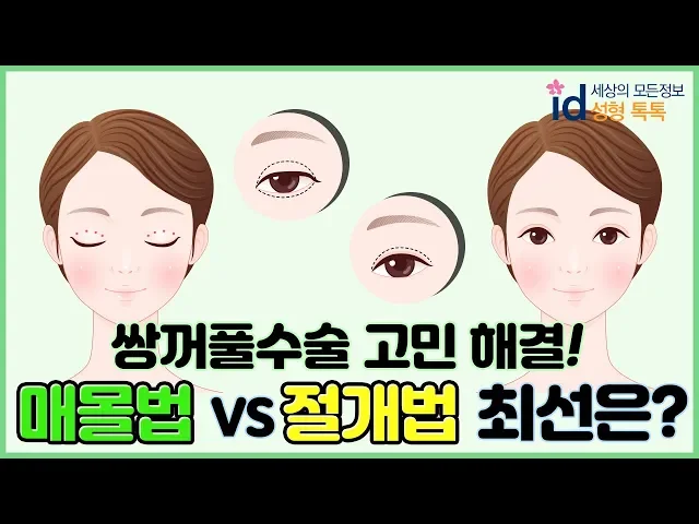 [성형톡톡] 나는 매몰로 해야해? 절개로 해야해? 성형 가상상담 체험! 이해하기 쉽게 설명하는 쌍꺼풀 수술 방법 매몰법VS절개법