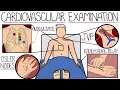 The Cardiovascular System Examination