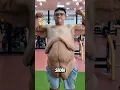 Download Lagu Inilah penyebab kulit bergelambir😱