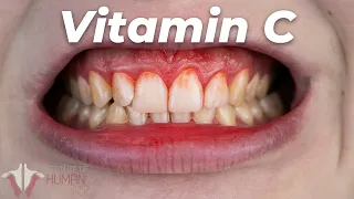 Download This is Why You Need Vitamin C Everyday MP3