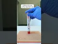 How to inject Cosentyx