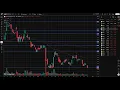 MBOT Stock Microbot Medical stock analysis MBOT STOCK PREDICTION analysis news today