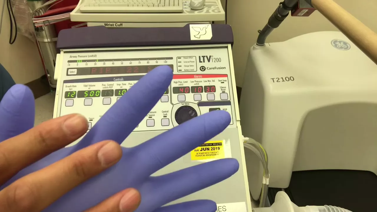 LTV 1200 ventilator: modes and settings