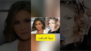 فنانات سوريا قبل وبعد عمليات التجميل 
