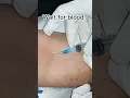 Download Lagu Easy and simple blood sampling from vein